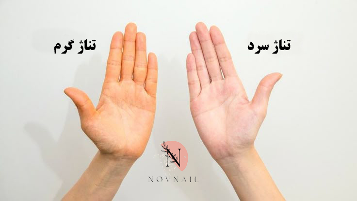 تناژ رنگ پوست